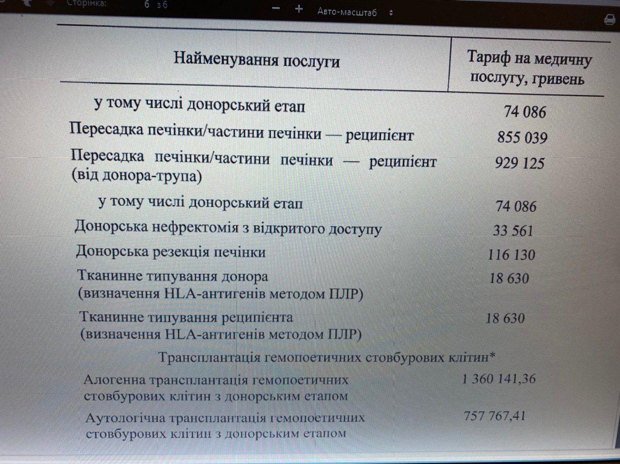 Кабмин утвердил цены на пересадку органов в Украине. Фото: Гончаренко