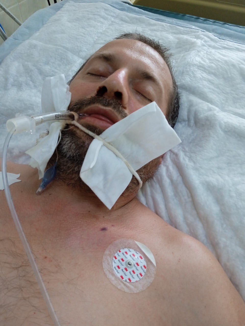 Фото (2) госпіталізованого після мобілізації